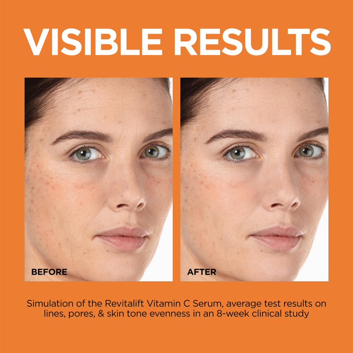 L'Oréal Paris Revitalift Vitamin C 12% Serum with Vitamin E & Salicylic Acid, 1 fl oz – Brightening & Skin Renewal